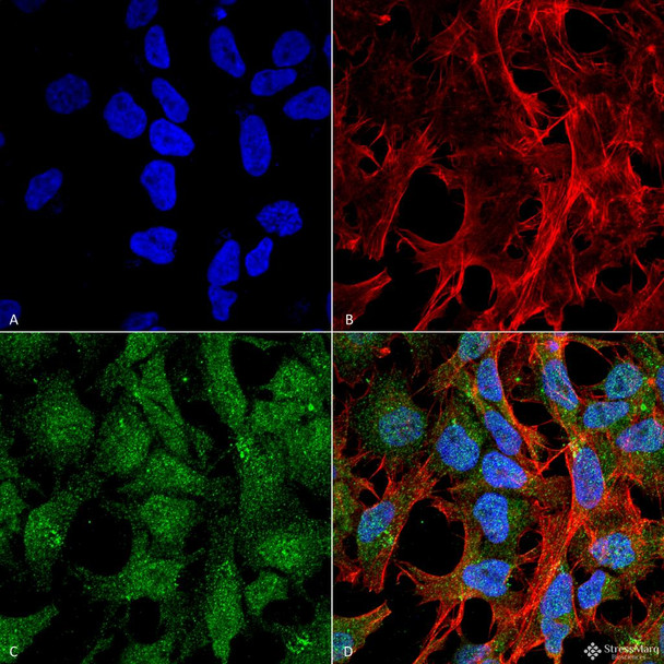 Immunocytochemistry/Immunofluorescence analysis using Rabbit Anti-UVRAG Polyclonal Antibody (STPA00059). Tissue: Neuroblastoma cell line (SK-N-BE). Species: Human. Fixation: 4% Formaldehyde for 15 min at RT. Primary Antibody: Rabbit Anti-UVRAG Polyclonal Antibody (STPA00059) at 1:100 for 60 min at RT. Secondary Antibody: Goat Anti-Rabbit ATTO 488 at 1:100 for 60 min at RT.