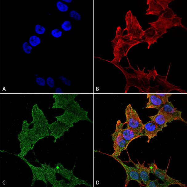 Immunocytochemistry/Immunofluorescence analysis using Rabbit Anti-ULK1 Polyclonal Antibody (STPA00063). Tissue: Neuroblastoma cell line (SK-N-BE). Species: Human. Fixation: 4% Formaldehyde for 15 min at RT. Primary Antibody: Rabbit Anti-ULK1 Polyclonal Antibody (STPA00063) at 1:100 for 60 min at RT. Secondary Antibody: Goat Anti-Rabbit ATTO 488 at 1:200 for 60 min at RT.
