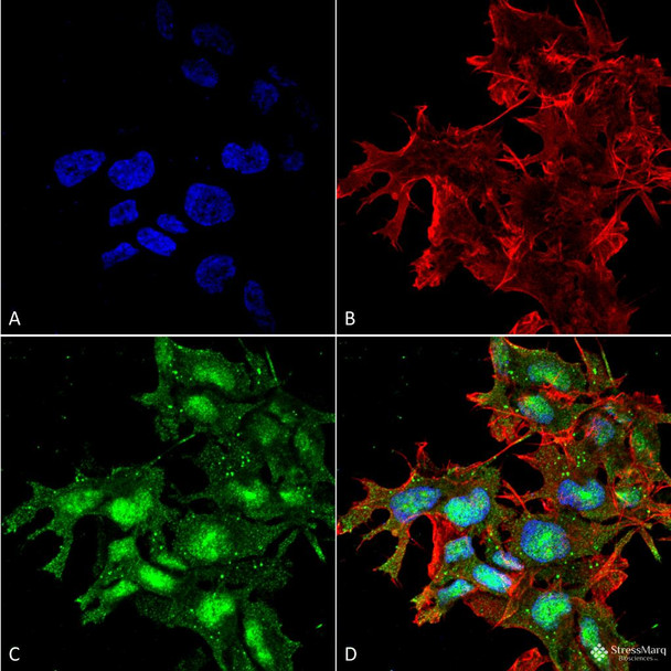 Immunocytochemistry/Immunofluorescence analysis using Rabbit Anti-ATG2A Polyclonal Antibody (STPA00066). Tissue: Neuroblastoma cell line (SK-N-BE). Species: Human. Fixation: 4% Formaldehyde for 15 min at RT. Primary Antibody: Rabbit Anti-ATG2A Polyclonal Antibody (STPA00066) at 1:100 for 60 min at RT. Secondary Antibody: Goat Anti-Rabbit ATTO 488 at 1:100 for 60 min at RT.