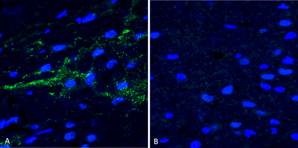 Immunohistochemistry analysis using Rabbit Anti-Alpha Synuclein (pSer129) Polyclonal Antibody (STPA00078). Tissue: Free floating brain sections. Species: Mouse. Fixation: PFA. Primary Antibody: Rabbit Anti-Alpha Synuclein (pSer129) Polyclonal Antibody (STPA00078) at 1:500 for overnight at 4C with gentle agitation. Counterstain: Hoechst. Magnification: 63X. A) Right hemisphere (striatum) injected with alpha synuclein AAV vector. B) Control.
