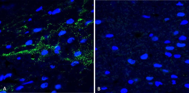 Immunohistochemistry analysis using Rabbit Anti-Alpha Synuclein (pSer129) Polyclonal Antibody (STPA00078). Tissue: Free floating brain sections. Species: Mouse. Fixation: PFA. Primary Antibody: Rabbit Anti-Alpha Synuclein (pSer129) Polyclonal Antibody (STPA00078) at 1:500 for overnight at 4C with gentle agitation. Counterstain: Hoechst. Magnification: 63X. A) Right hemisphere (striatum) injected with alpha synuclein AAV vector. B) Control.