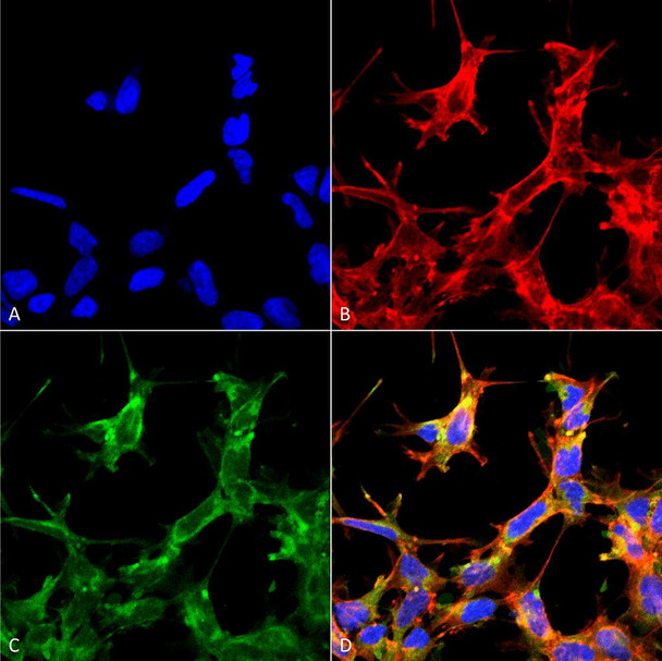 Immunocytochemistry/Immunofluorescence analysis using Rabbit Anti-HSP70 Acetyl Lys77 Polyclonal Antibody (STPA00079). Tissue: Embryonic kidney cells (HEK293) cultured overnight with 50 µM H2O2. Species: Human. Fixation: 5% Formaldehyde for 5 min. Primary Antibody: Rabbit Anti-HSP70 Acetyl Lys77 Polyclonal Antibody (STPA00079) at 1:60 for 30-60 min at RT. Secondary Antibody: Goat Anti-Rabbit Alexa Fluor 488 at 1:1500 for 30-60 min at RT.