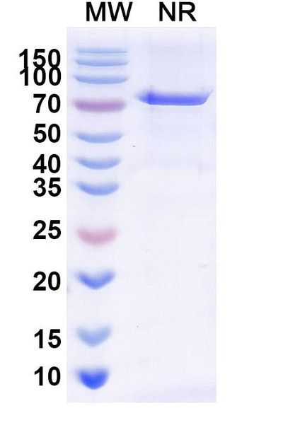 Radretumab Antibody - SDS-PAGE