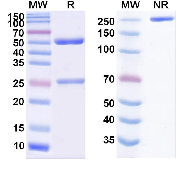 Valanafusp Alfa (Research-Grade) - SDS-PAGE