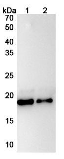Human IL11 Antibody (X203) - WB
