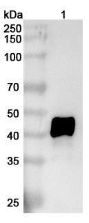 Human IL11RA Antibody (X209) - WB