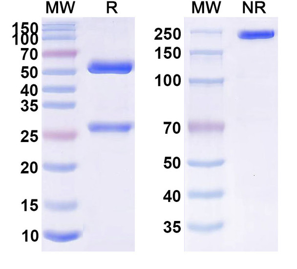 Human APP/Amyloid beta (AAB-003) Antibody - SDS-PAGE
