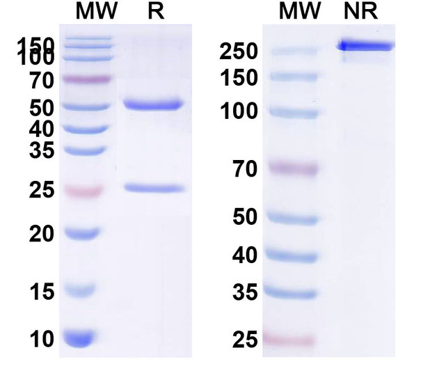 Human ASGR1 (SBT8230) Antibody - SDS-PAGE