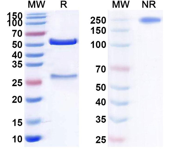 Human C5 (MUBODINA) Antibody - SDS-PAGE