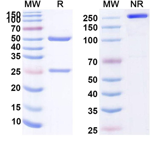Human CD198/CCR8 (CM369) Antibody - SDS-PAGE
