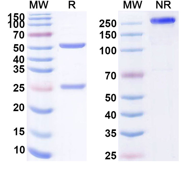 Human CD160 (MAT 302) Antibody - SDS-PAGE