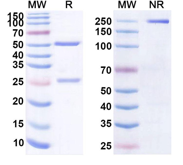 Human CD19 (ALLO-501) Antibody - SDS-PAGE