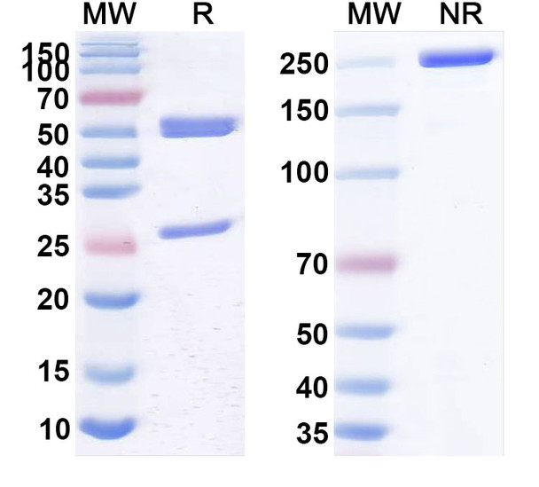 Human CD26/DPP4 (YS110) Antibody - SDS-PAGE