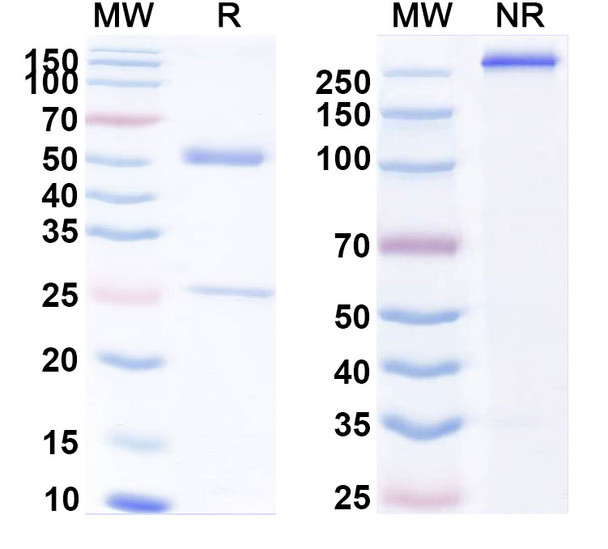 Human CD86/B7-2 (PG140) Antibody - SDS-PAGE