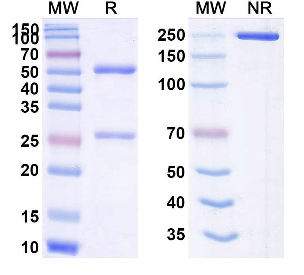 Human CD66e/CEA/CEACAM5 (BDC-2034) Antibody - SDS-PAGE