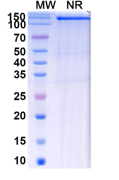 Batiraxcept (Research-Grade) - SDS-PAGE