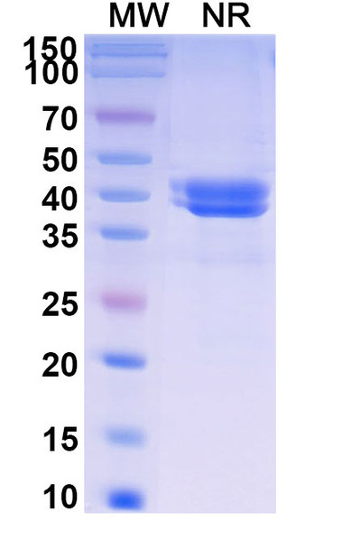 Ontorpacept (Research-Grade) - SDS-PAGE