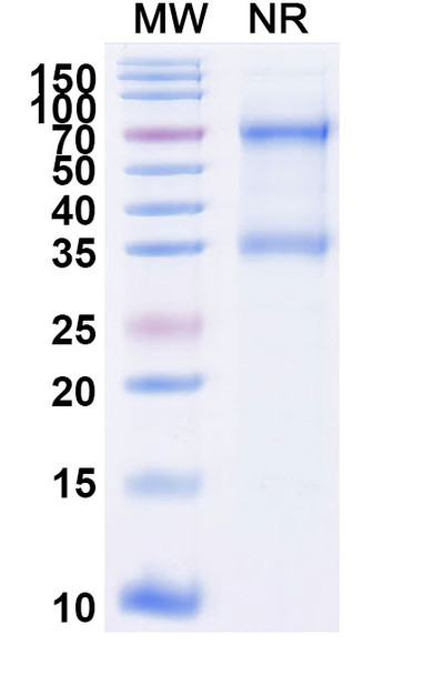 Tenecteplase (Research-Grade) - SDS-PAGE