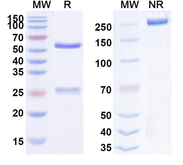 Human CD332/FGFR2 (GP369) Antibody - SDS-PAGE