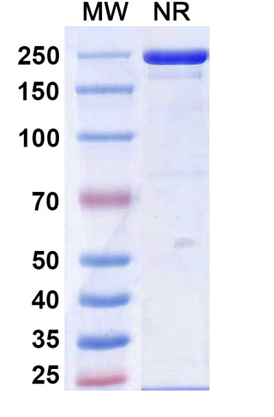 Calpurbatug Antibody - SDS-PAGE