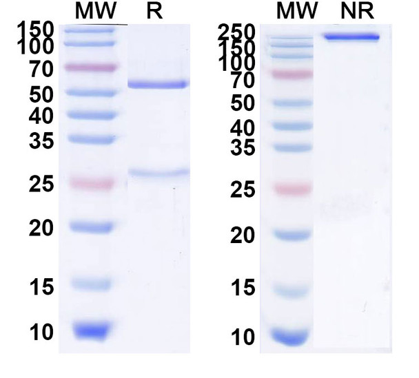 Freneslerbart Antibody - SDS-PAGE