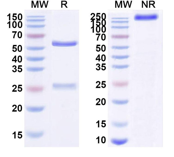 Human CD340/ERBB2/HER2/NEU (VB7-756) Antibody - SDS-PAGE