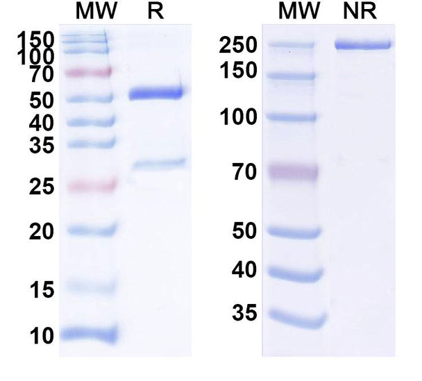 Human IFNAR1 (QX 006N) Antibody - SDS-PAGE