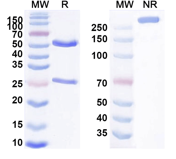 Human KAAG1 Antibody (AB-3A4) - SDS-PAGE