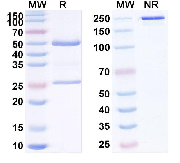 Human CD85d/LILRB2/ILT4 (ATG 032) Antibody - SDS-PAGE