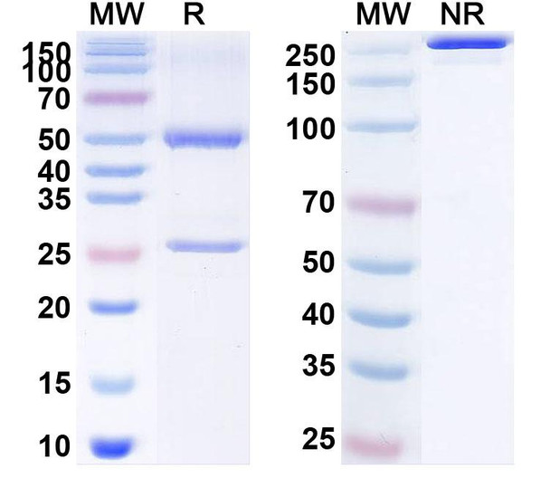 Human CD73/NT5E (JAB-BX102) Antibody - SDS-PAGE
