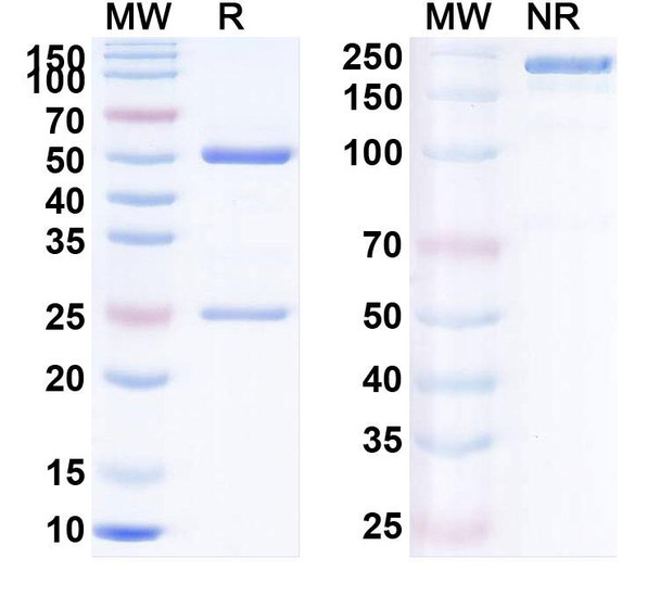 Human CD279/PDCD1/PD1 (AM0001) Antibody - SDS-PAGE
