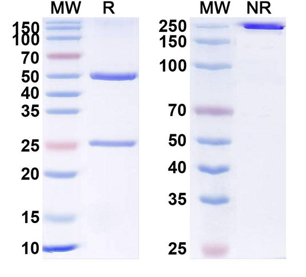 Human VSIR/VISTA (W0180) Antibody - SDS-PAGE