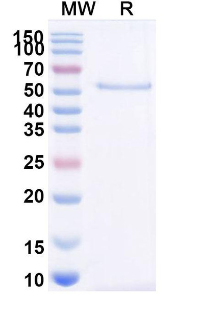 Acimtamig Antibody - SDS-PAGE