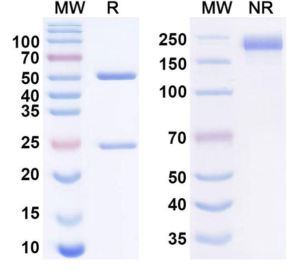 Human CD156b/ADAM17 Antibody (D5P2A11/D5) - SDS-PAGE