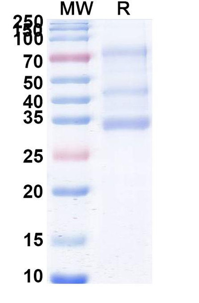 Sozinibercept (Research-Grade) - SDS-PAGE