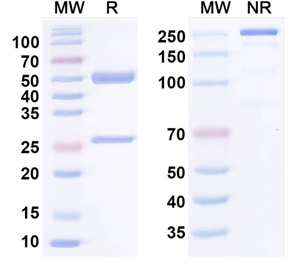 Human CD136/MST1R Antibody (H5B14) - SDS-PAGE