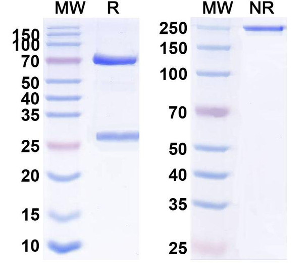 Human CD18/ITGB2 (H52) Antibody - SDS-PAGE