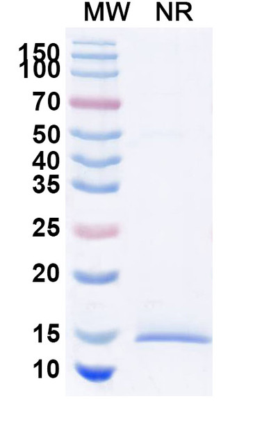 Anti-Human HTT Recombinant Nanobody (SAA1033) - SDS-PAGE