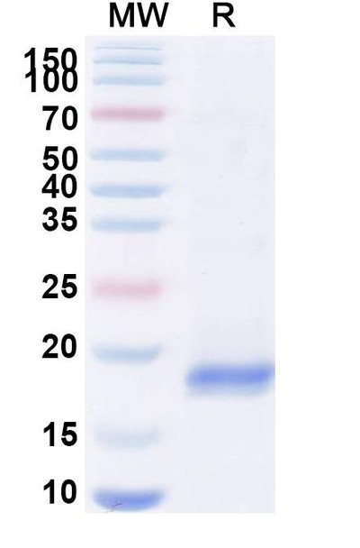 Anti-Human BLM Recombinant Nanobody (SAA0979) - SDS-PAGE