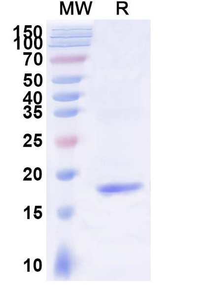 Anti-Human BACE2 Recombinant Nanobody (SAA1007) - SDS-PAGE