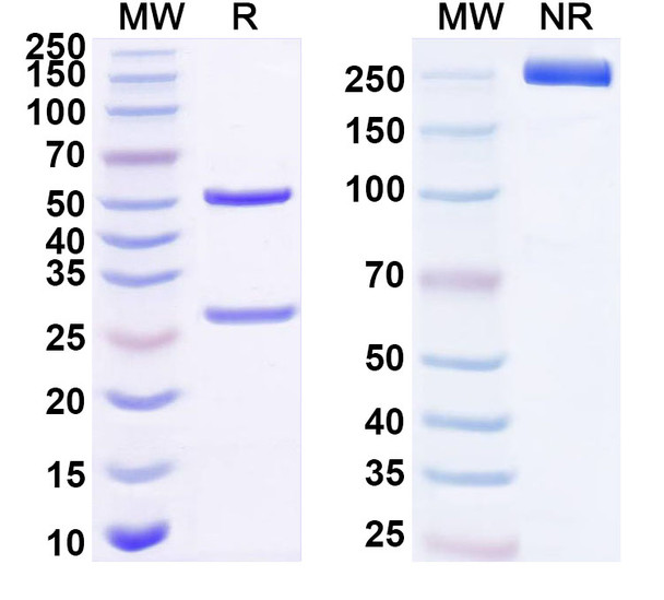 Anti-Human CKAP4 Recombinant Monoclonal Antibody (SAA1661) - SDS-PAGE