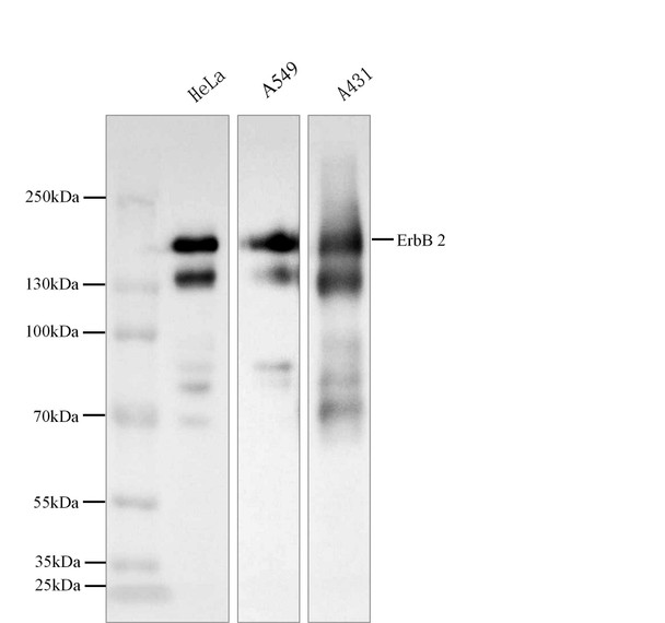 Recombinant HER2/ErbB2/CD340 Monoclonal Antibody (AGEL5325)