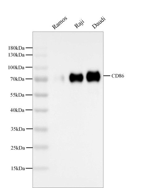 Recombinant CD86/B7-2 Monoclonal Antibody (AGEL5328)