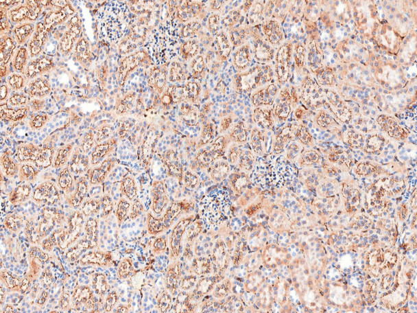 Recombinant B2M/beta-2 microglobulin Monoclonal Antibody (AGEL5336)