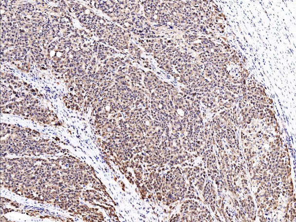Recombinant 4E-BP1/EIF4EBP1 Monoclonal Antibody (AGEL5357)