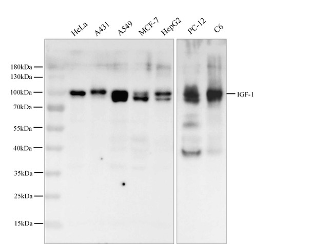 Recombinant IGF1R/CD221 Monoclonal Antibody (AGEL5359)