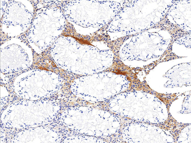 Recombinant CLEC3B/Tetranectin Monoclonal Antibody (AGEL5369)