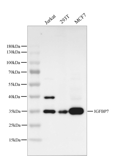 Recombinant IGFBP7 Monoclonal Antibody (AGEL5370)