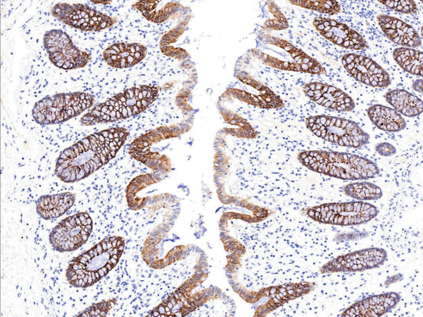 Recombinant PIGR Monoclonal Antibody (AGEL5379)