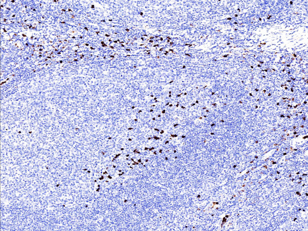 Recombinant S100A9 Monoclonal Antibody (AGEL5381)